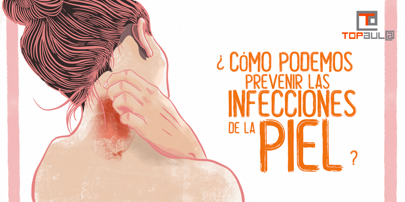 ¿Cómo podemos prevenir las infecciones de la piel? - www.topaula.com