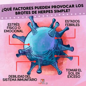Infografía - Herpes simple: Causas y tratamiento - www.topaula.com